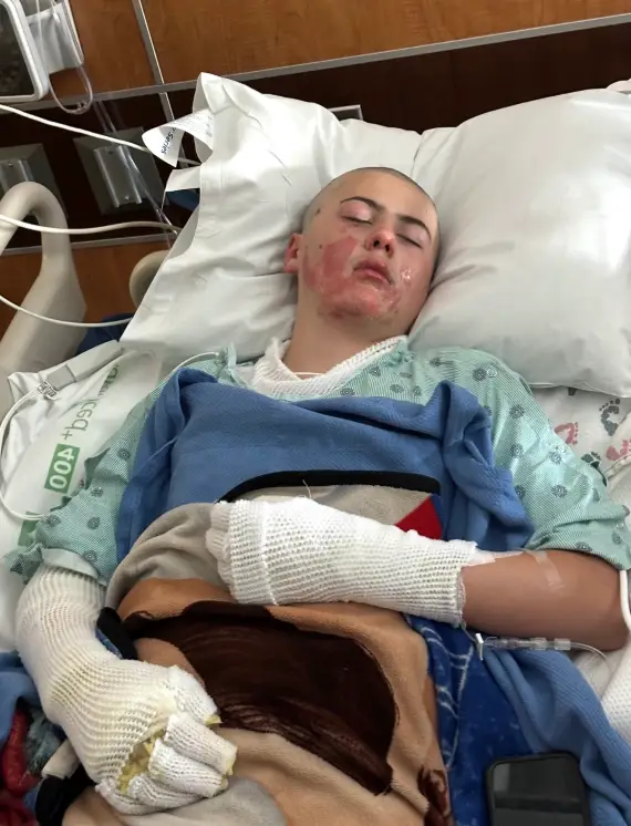 A fundraiser has since been created to help pay for the pre-teen's medical bills (GoFundMe)