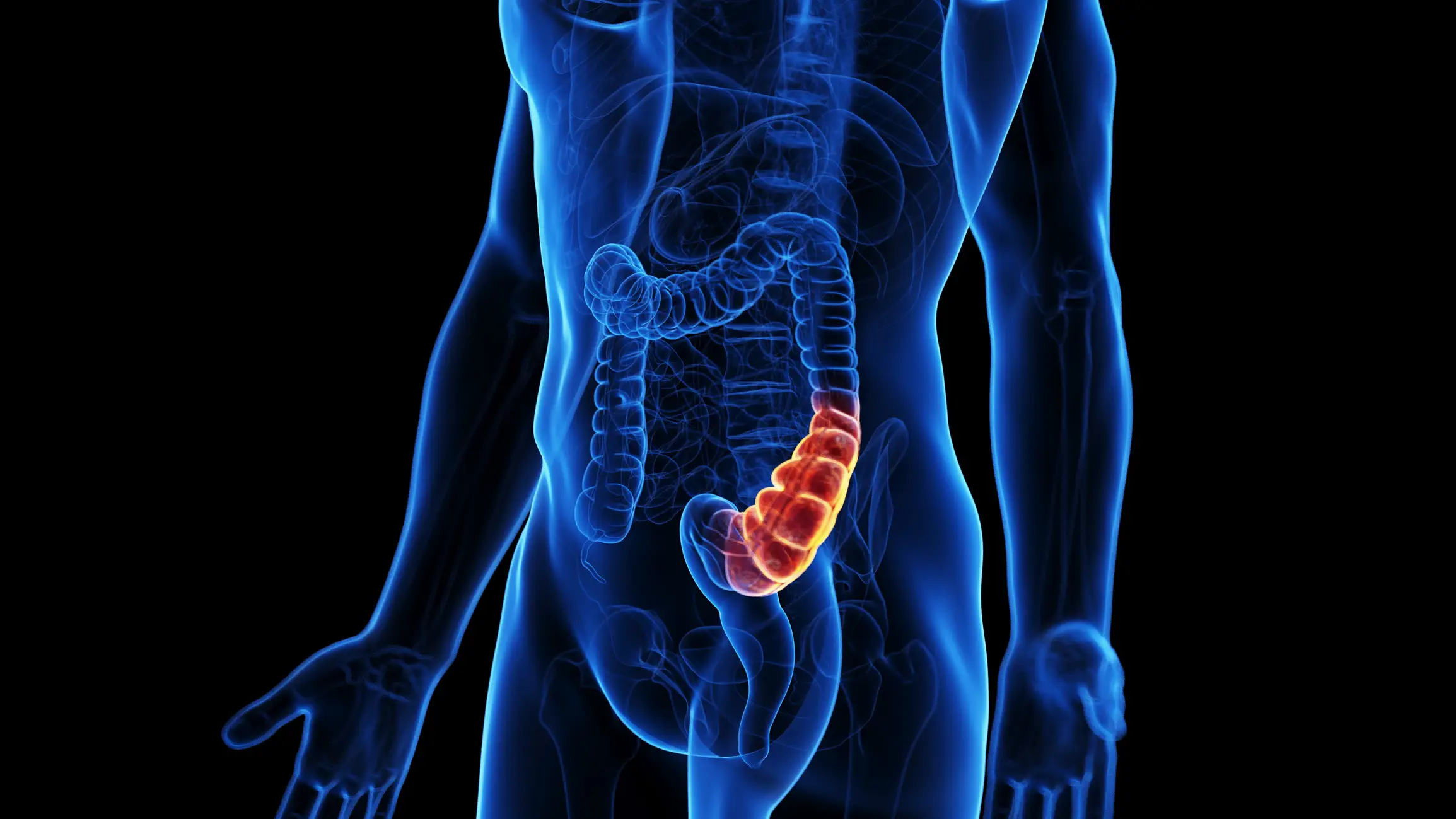 One particular diet can seriously reduce your risk of developing a 'silent killer' (SEBASTIAN KAULITZKI/SCIENCE PHOTO LIBRARY / Getty Images)