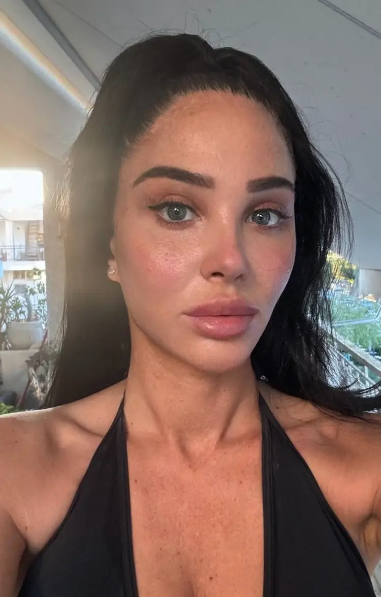 The 'Female Boss' was diagnosed with Bell’s palsy back in 2020 (Instagram/@tulisacontostavlos)