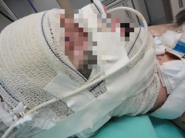 She was in the coma for over two weeks. (Jam Press/@‌jaque_gmack)