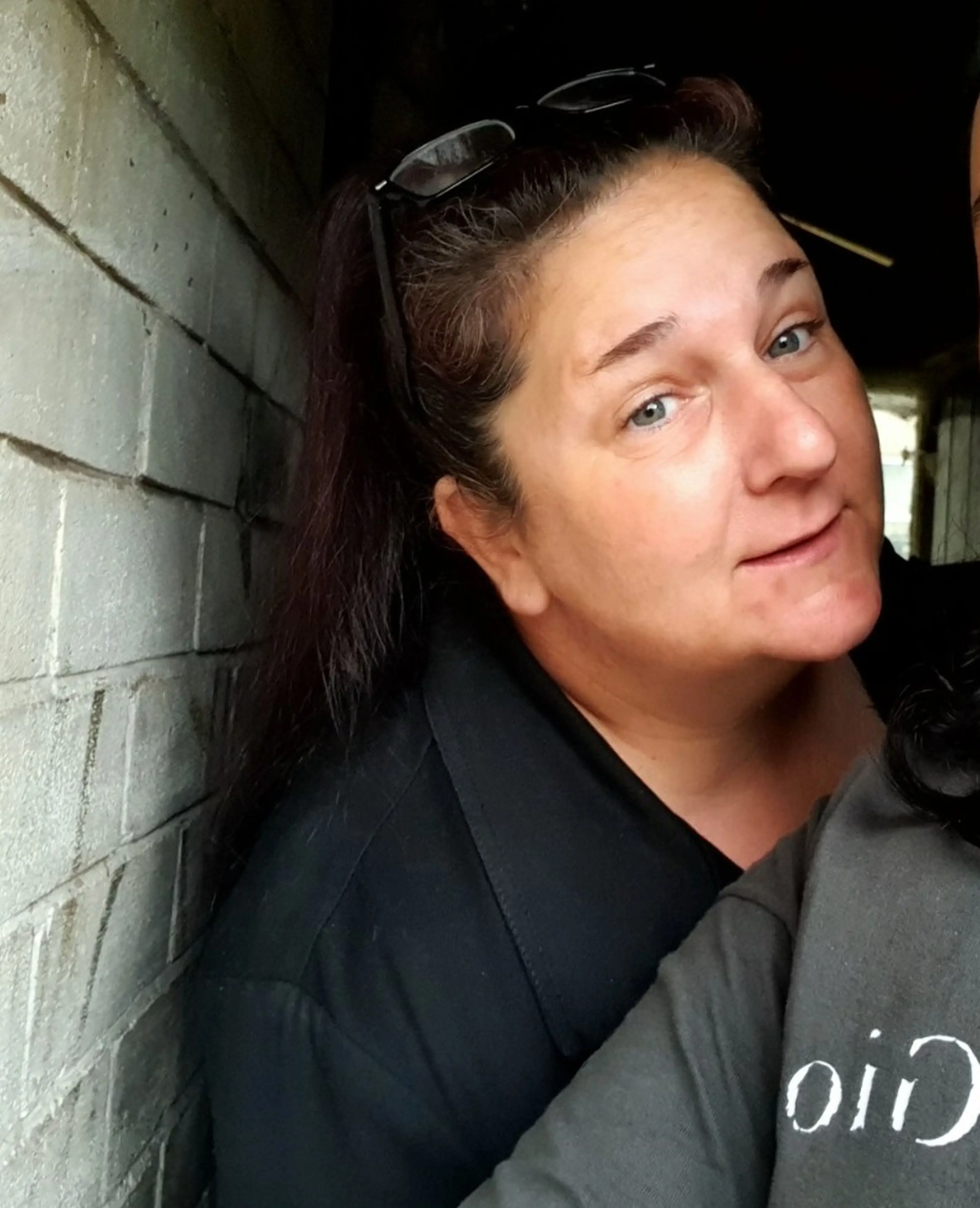 Lindsey Thwaites started experiencing soreness and bleeding earlier this year.