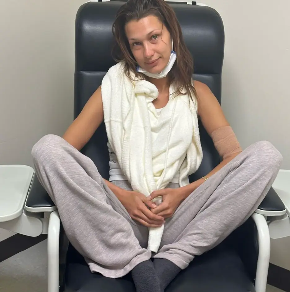 Bella Hadid is among the famous faces who have spoken out about their struggles with the illness (Instagram/BellaHadid)