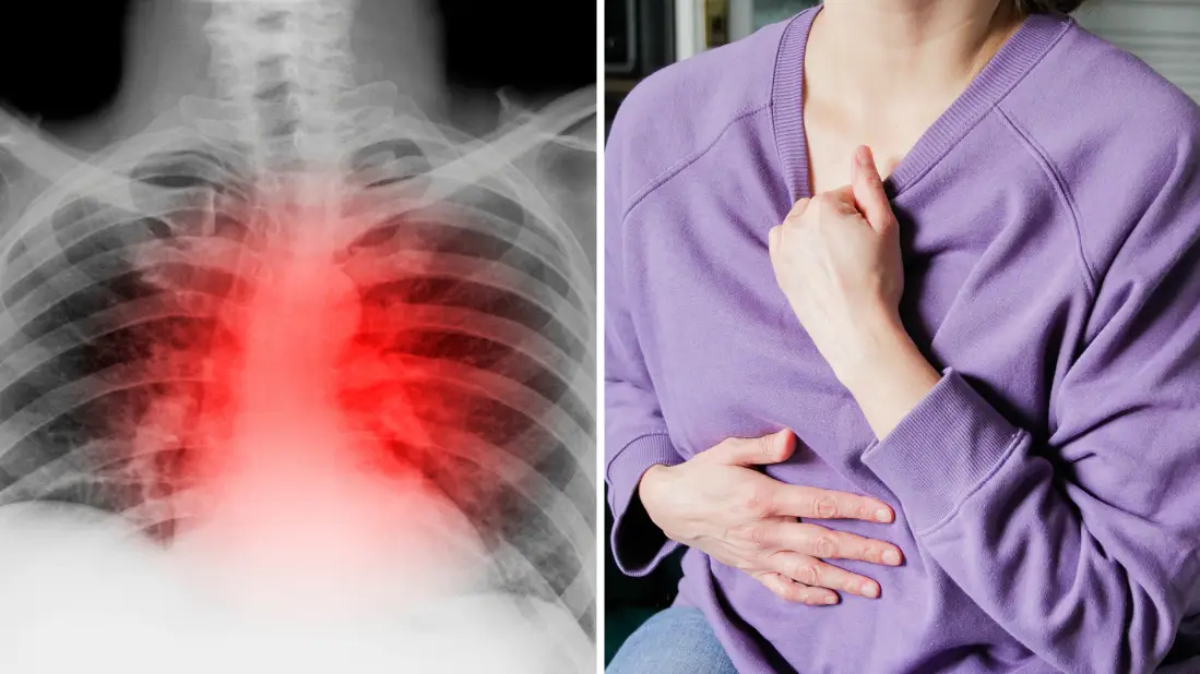 Heart attack symptoms you could experience one month before it actually happens