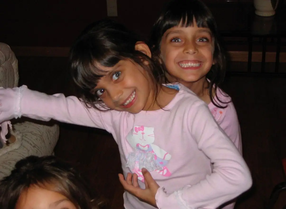 The twins were born with an extremely rare condition (SWNS)