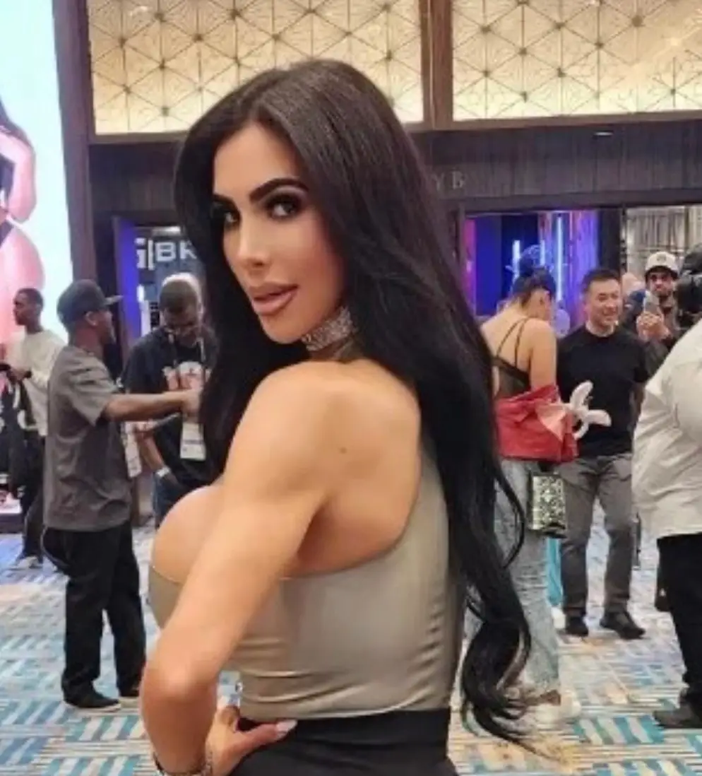 The 34-year-old died while recovering from surgery.