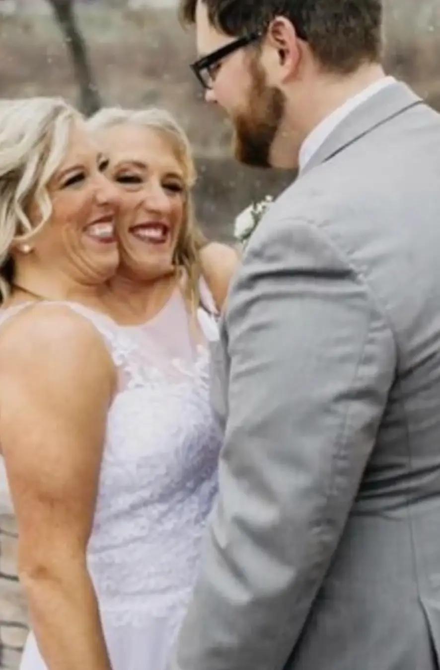 Abby tied the knot back in 2021. (TikTok/@abbyandbrittanyhensel)