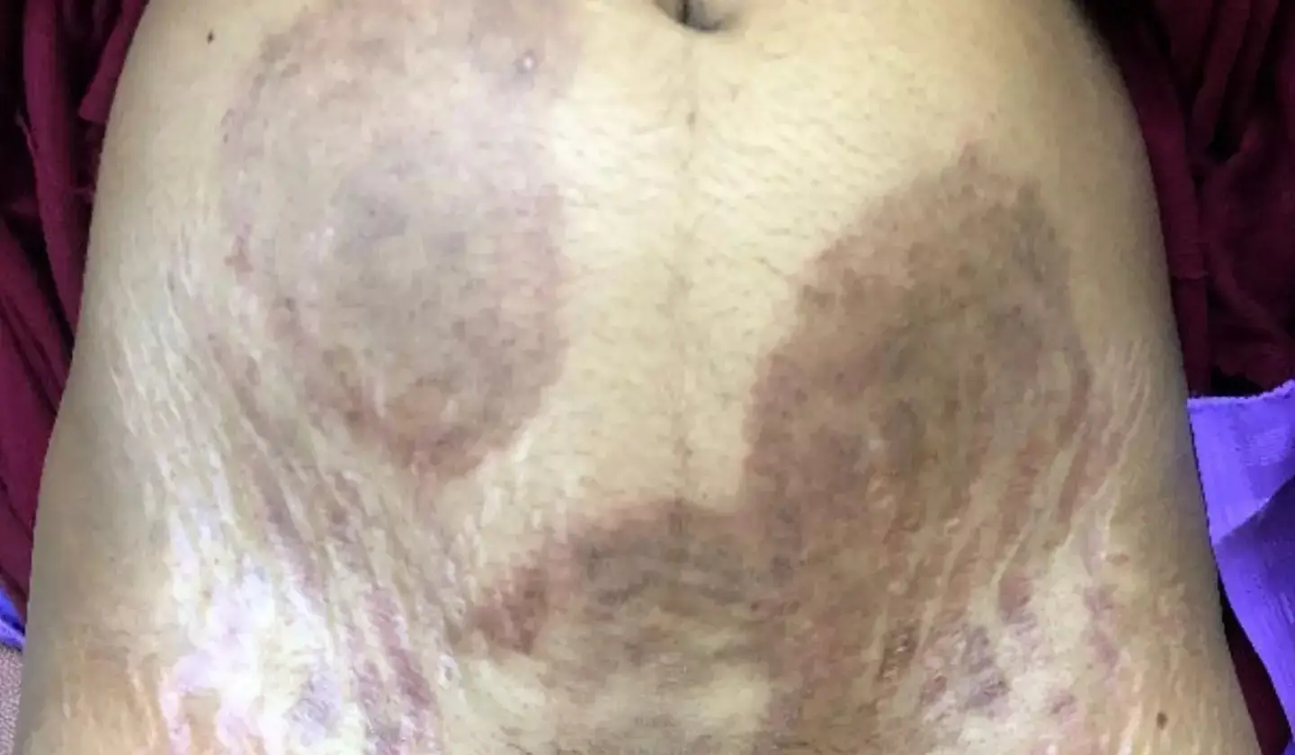 It is said to be highly contagious (MDPI)