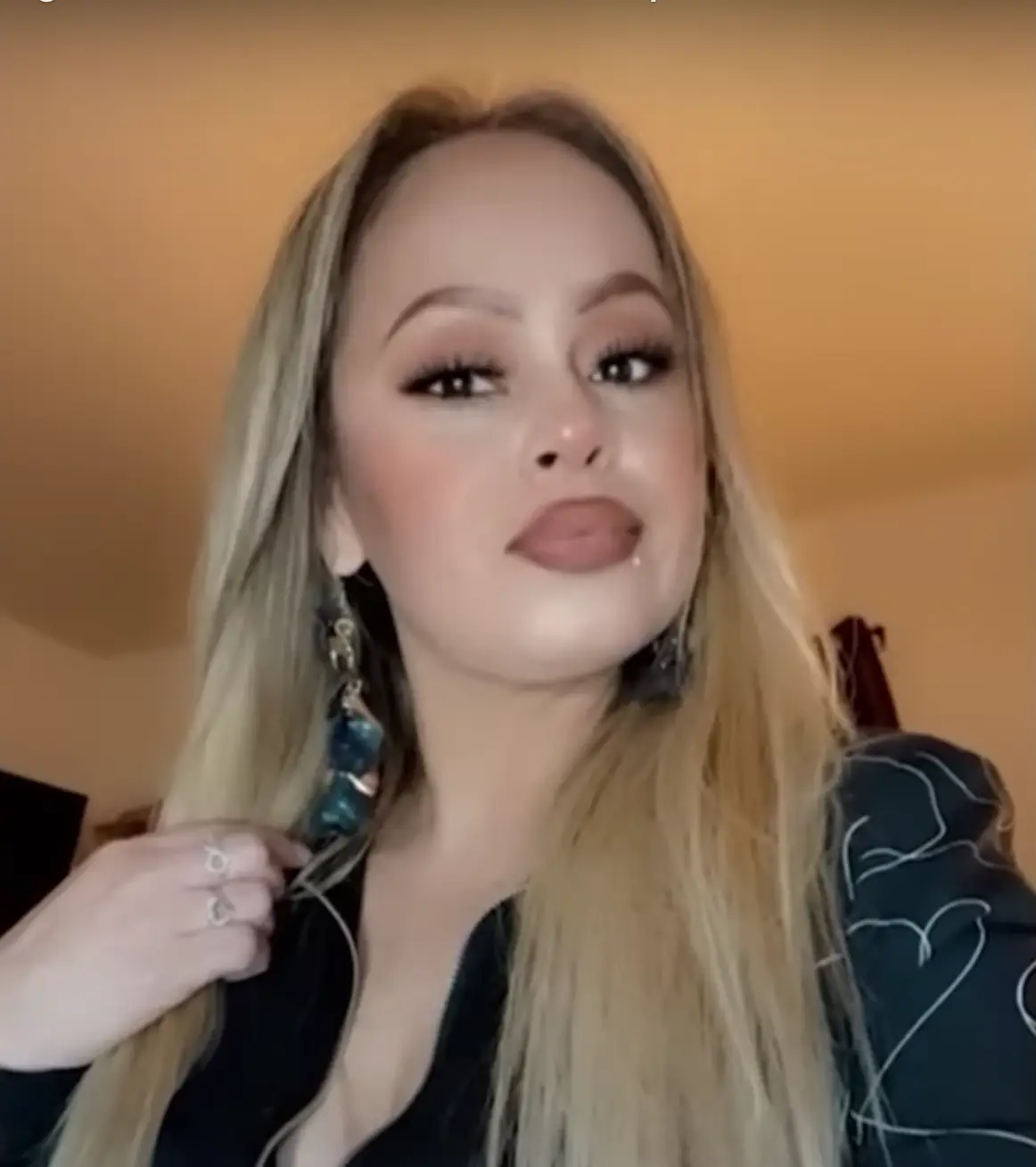 Barajas had four limbs amputated after being hospitalised.