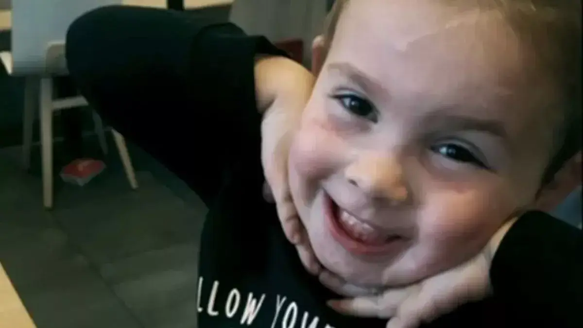 Two-year-old Ella was mauled by five dogs.