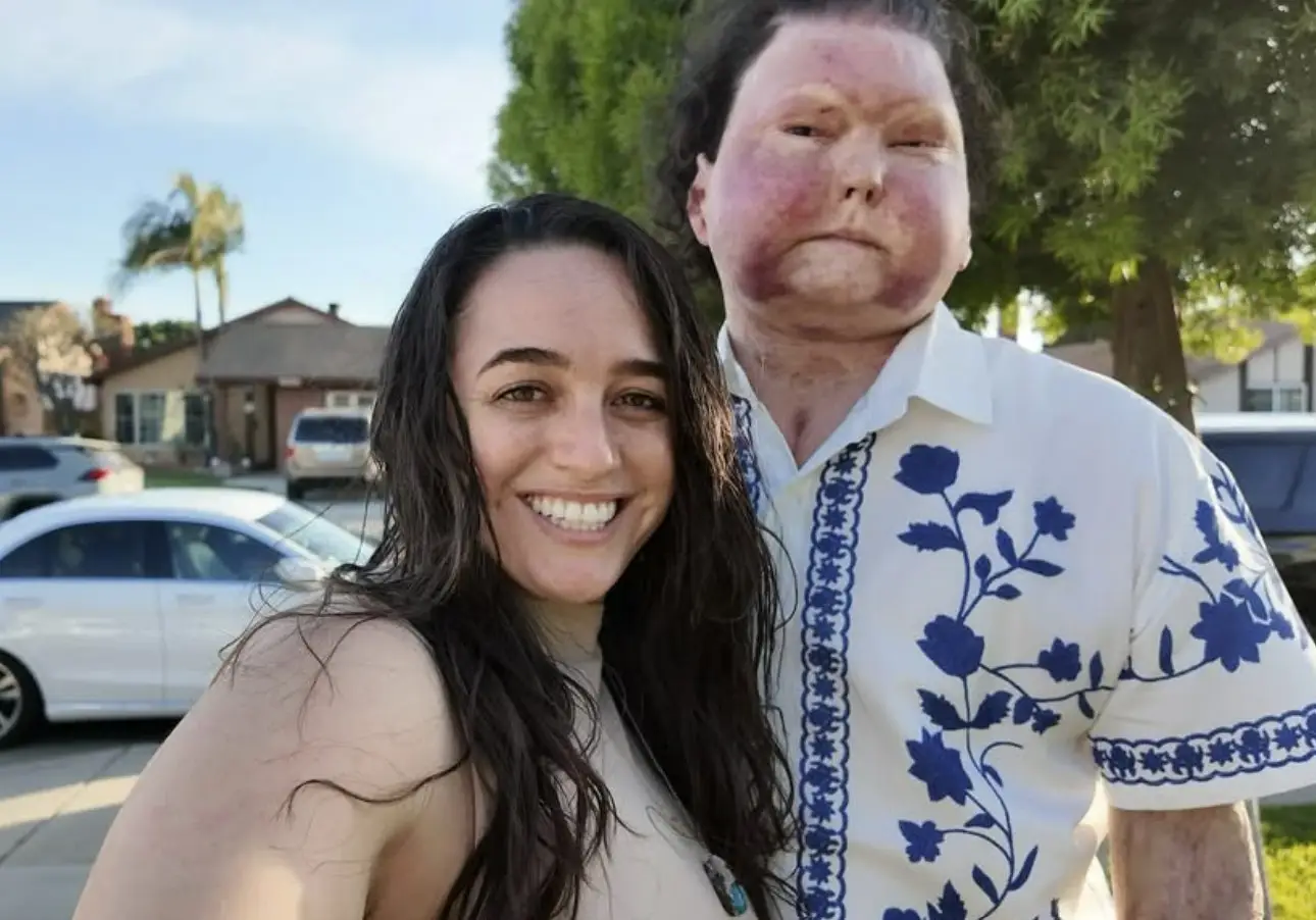 Joe met his now wife Jessica after his accident when she messaged him on Instagram (Instagram/@joeroydimeo)