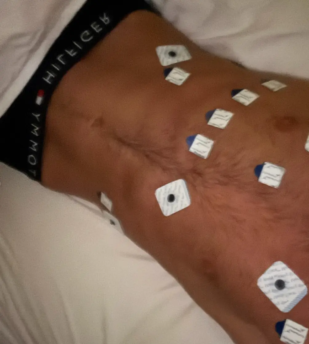 Fraser said he will 'never' use a vape ever again following the health scare (Instagram/@fraserolender)