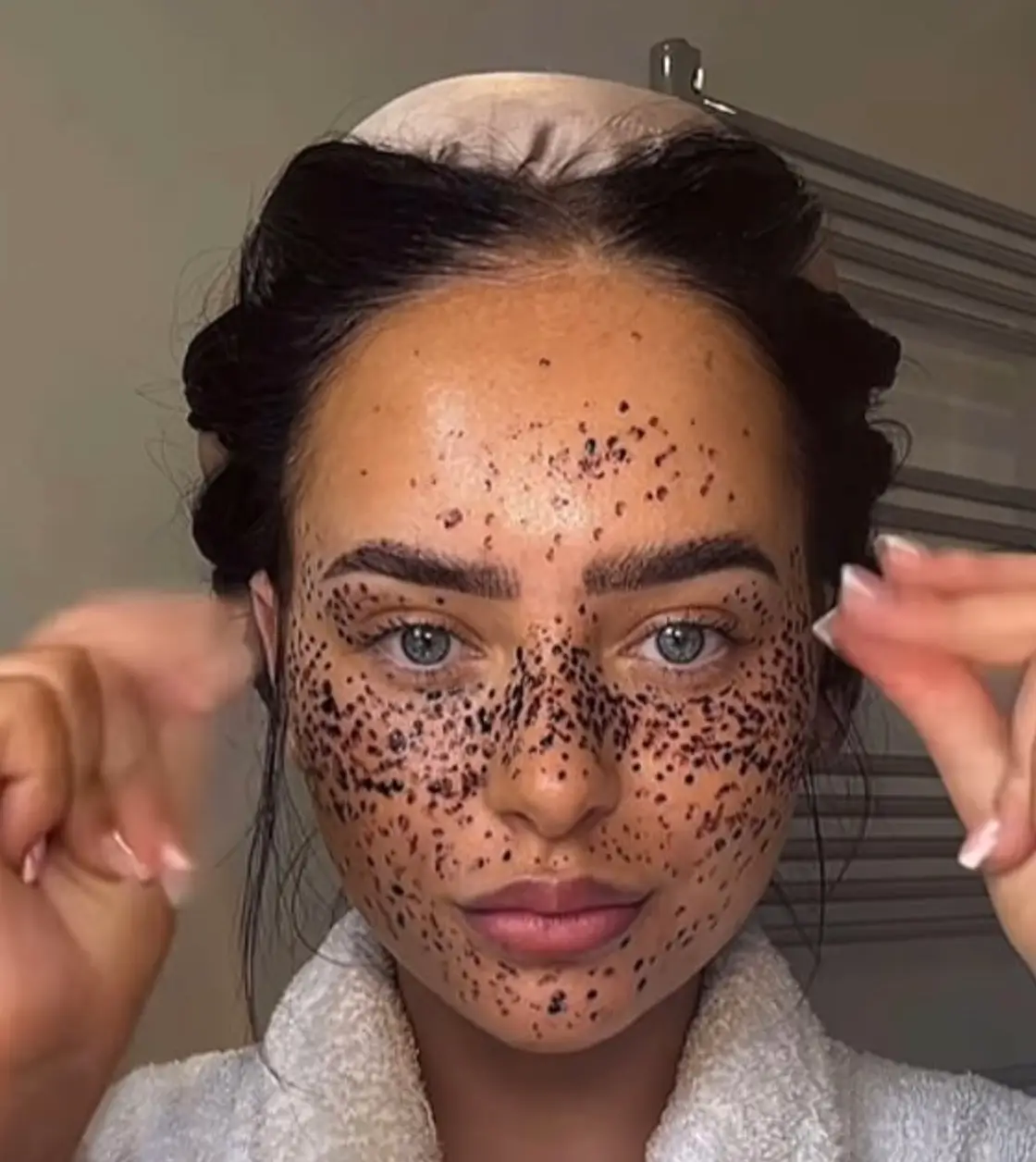 “It looks like a bad condition.” (Instagram/@ellejamesmakeup)