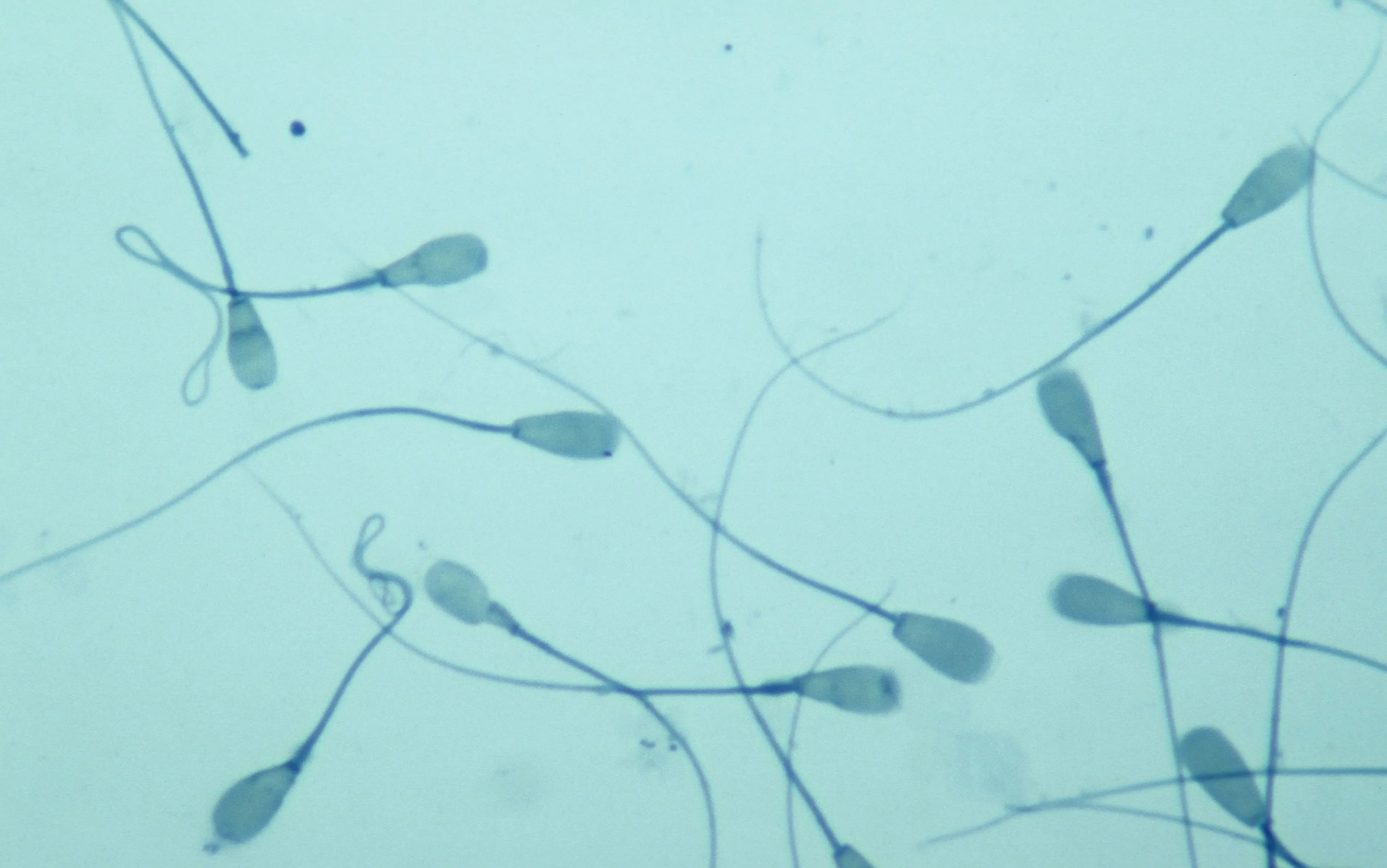 New research has revealed that sperm mutations are more common the older men get (Getty Stock Image)