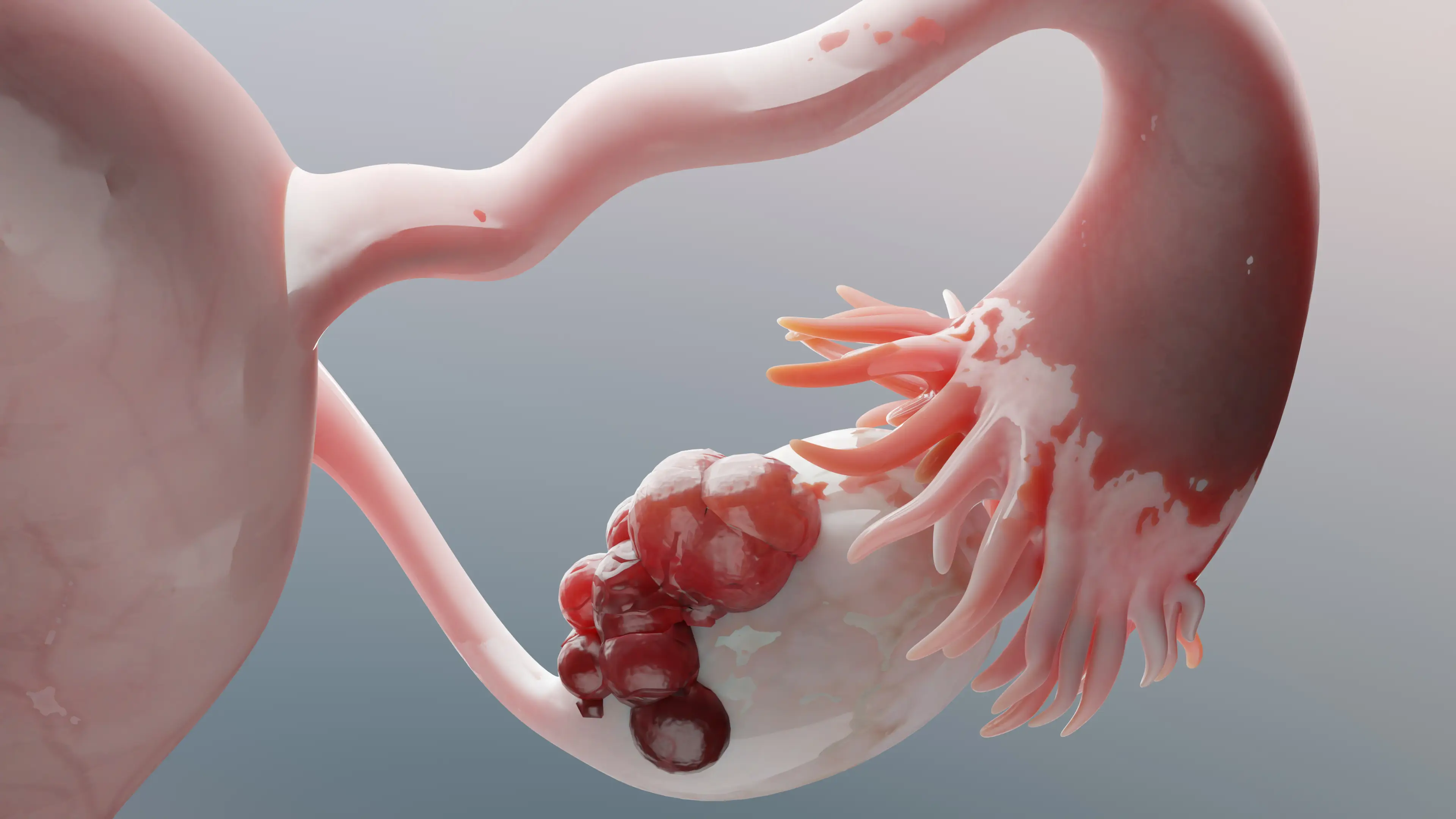 Most cysts occur naturally and go away in a few months (Getty Stock Images)