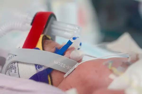 The babies are still being cared for at the NICU (Metro North Health)