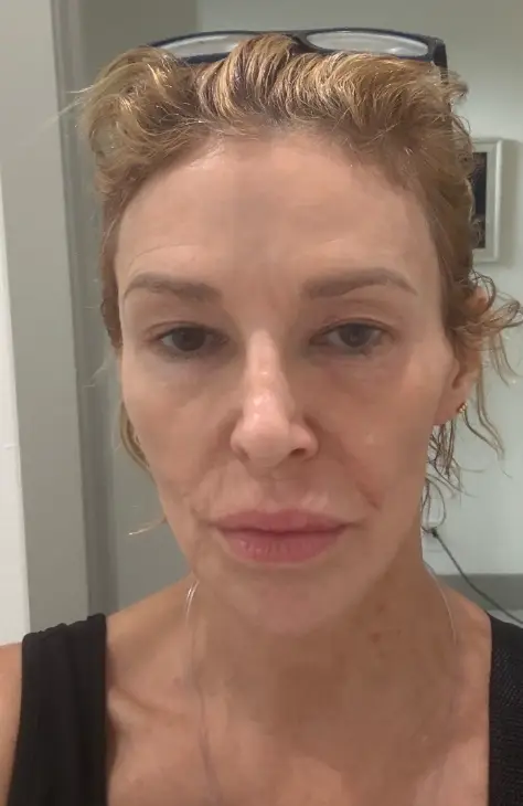 The reality TV star believes there's something 'alive' underneath her skin (Instagram/brandiglanville)