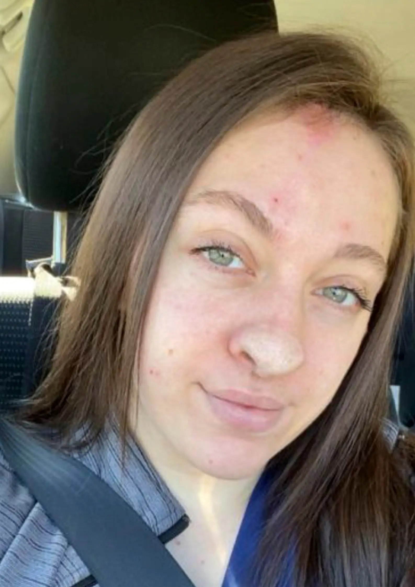 Trinity has already had four surgeries since the attack.