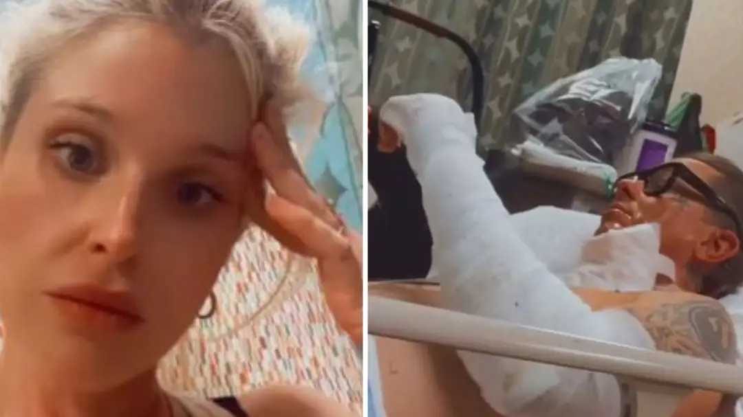 Kelly Osbourne issues warning after boyfriend is hospitalised with horrific burn injuries