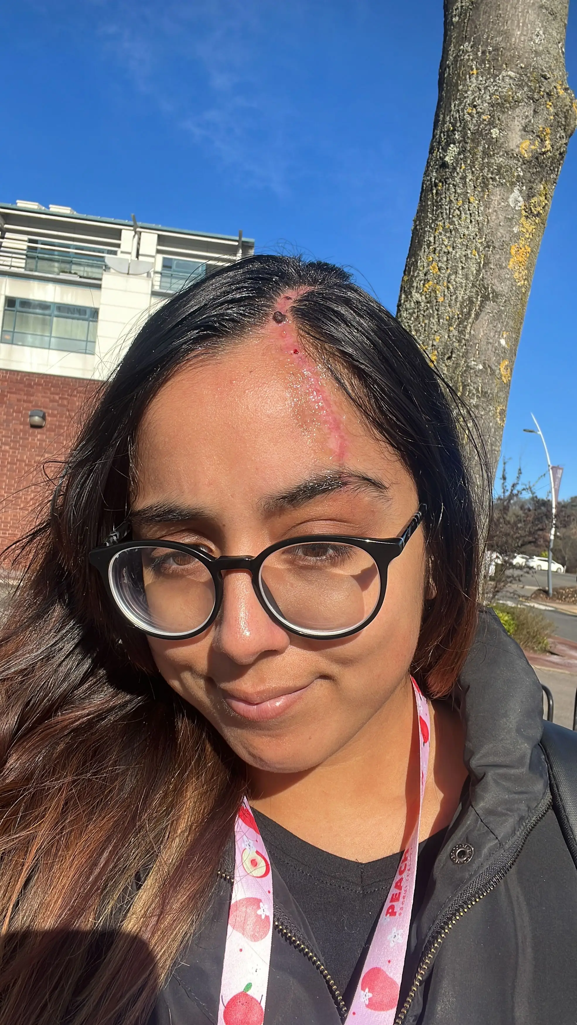 Jeena is now urging other motorists to not wear claw clips while driving and to opt for using an elastic bobble instead.