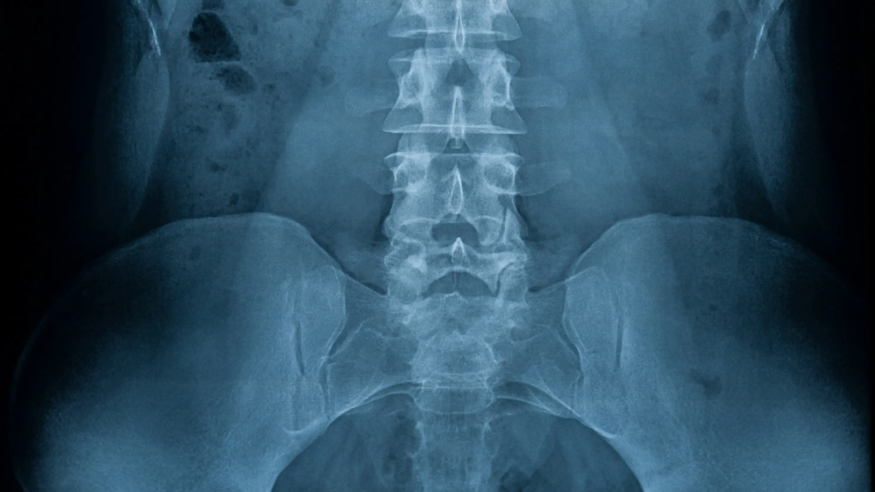 Disturbing list of things that got stuck up people’s penises last year revealed by government