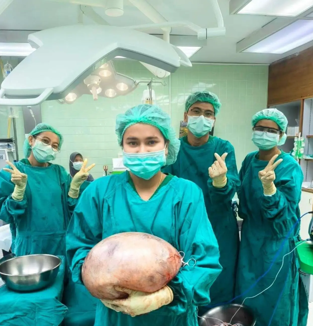 The huge cyst measured 30cm across (Facebook/คลินิกสูตินรีเวชหมอธมน สตูล)