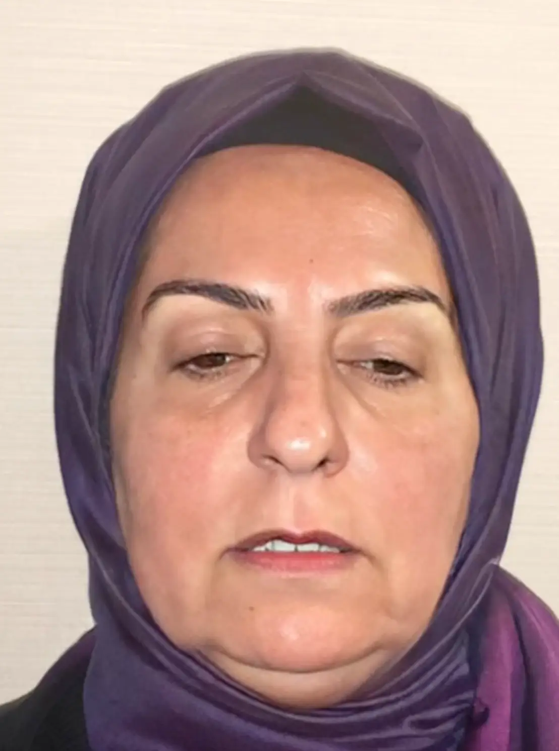 The internets' minds have been blown by the 'insane' before and after cosmetic surgery transformation.