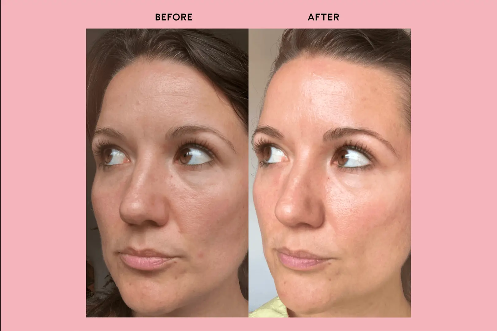 People have said the food supplement left their skin feeling 'plumped' (Feel)