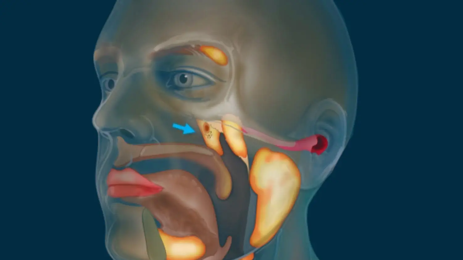 Netherlands Cancer Institute