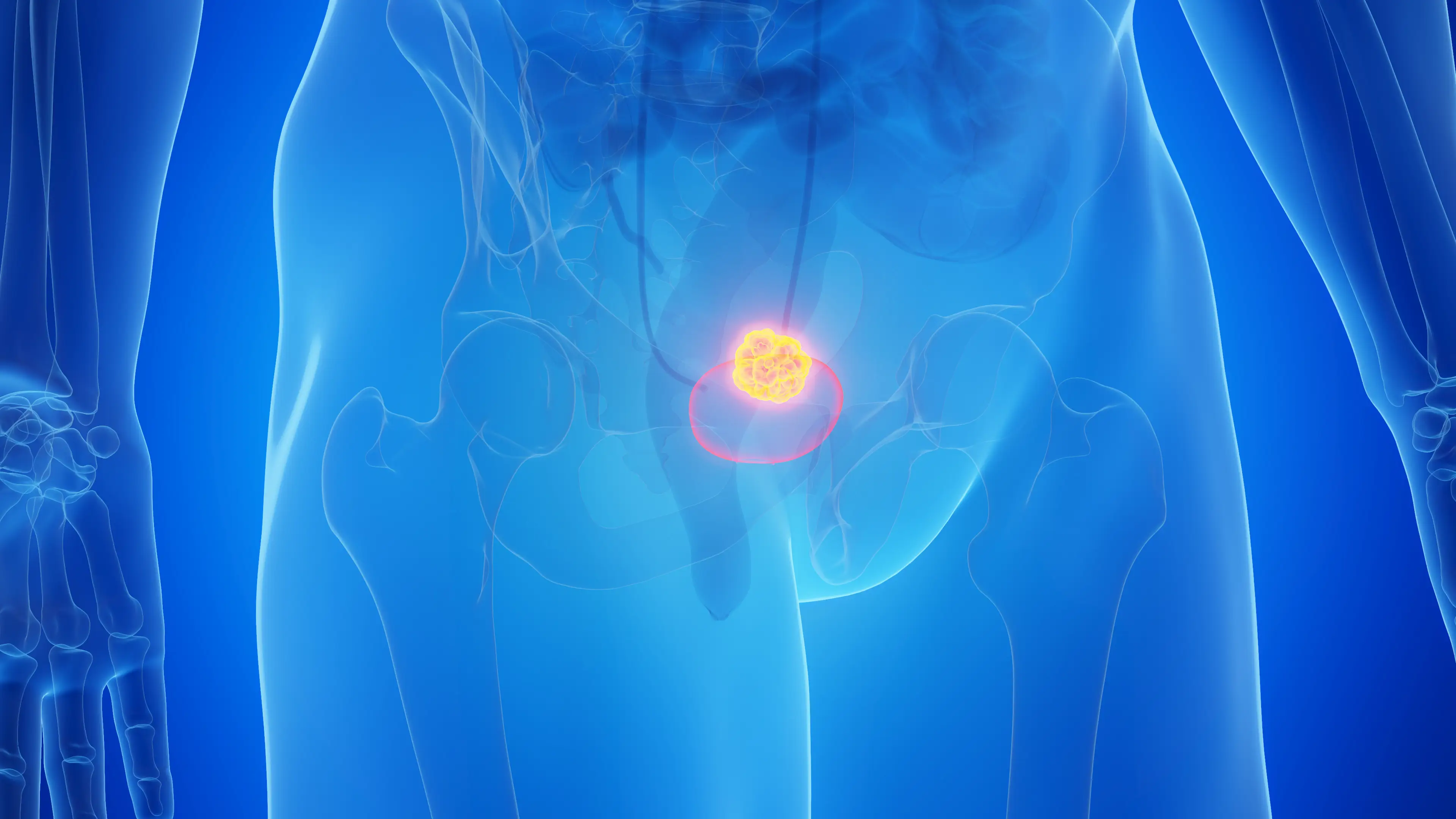 Bladder cancer survivors have spokem out on the 'most common' symptoms they all experienced (Getty Stock Images)