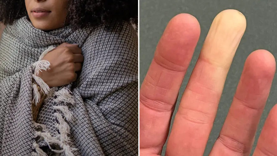 Getty Stock Images/Marli Miller/UCG/Universal Images Group via Getty Images