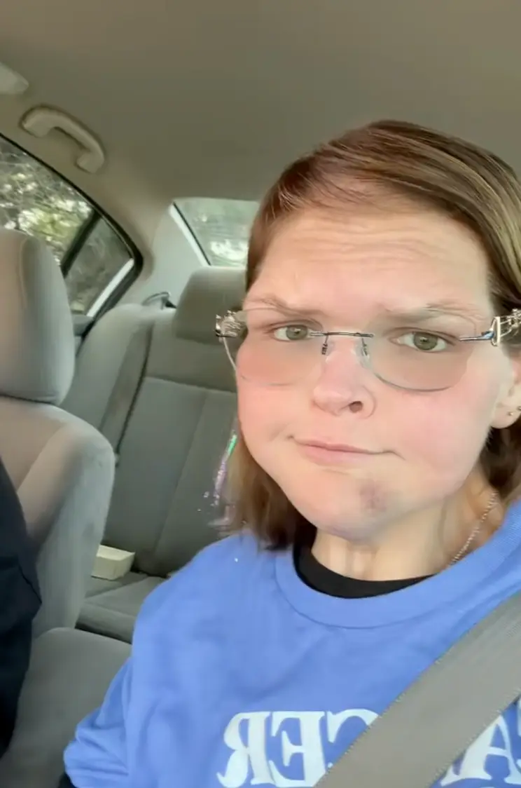 Fans were worried about the bruising on Tammy's face (TikTok/@tammy.l.slaton)