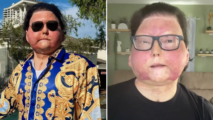 Instagram/@joeroydimeo/TikTok/@joedimeo