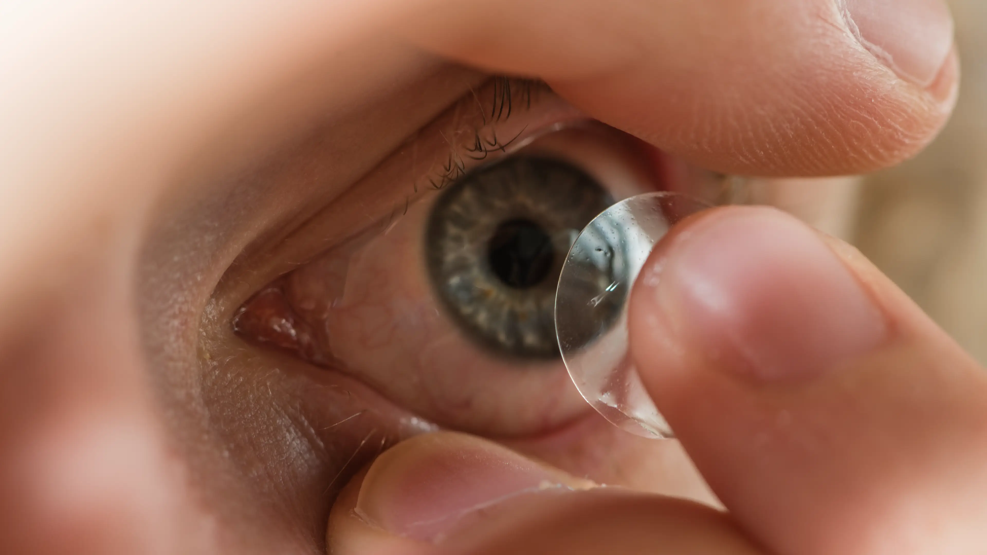 Doctor removed 23 contact lenses from patient's eye after she ‘forgot’ to take them out