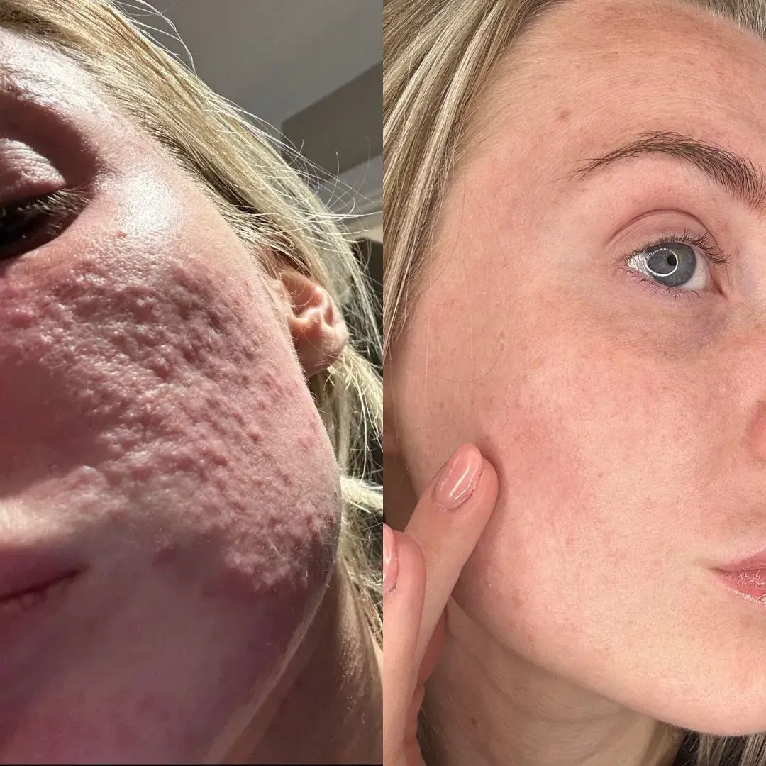 People say the silver mask has been 'life changing' (47 Skin)