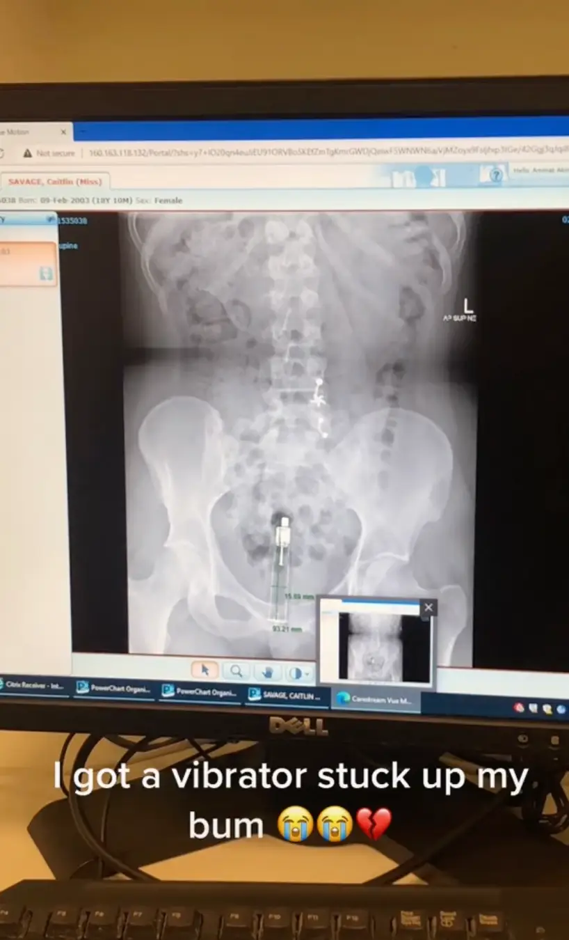 Caitlin said she was mortified.