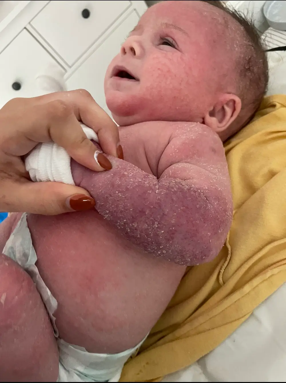 Emily tried multiple prescribed products and antibiotics for her poor daughter, to no avail.