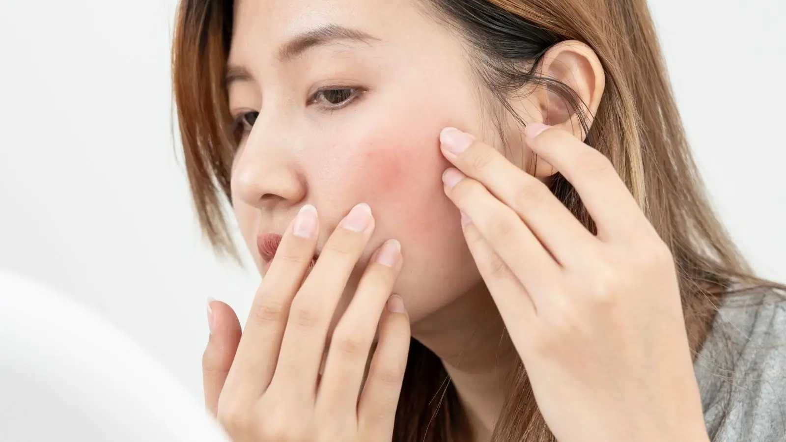 A compromised skin barrier can show up as sensitivity and redness, (Nuttawan Jayawan/Getty Images)