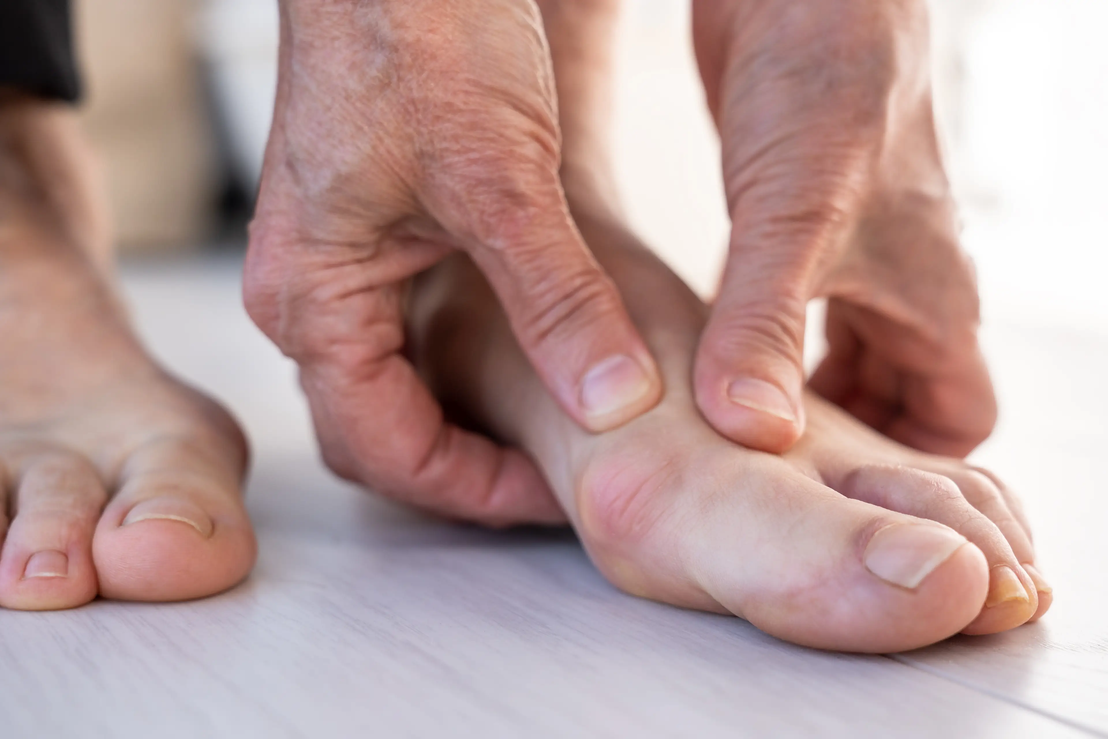 Scientists have various theories on why bunions form (Getty Stock Image)