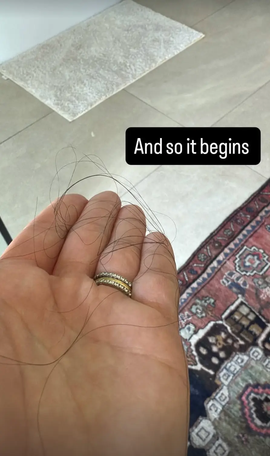 The actress has opened up about her struggles with hair loss, four months postpartum (Instagram/vanessahudgens)