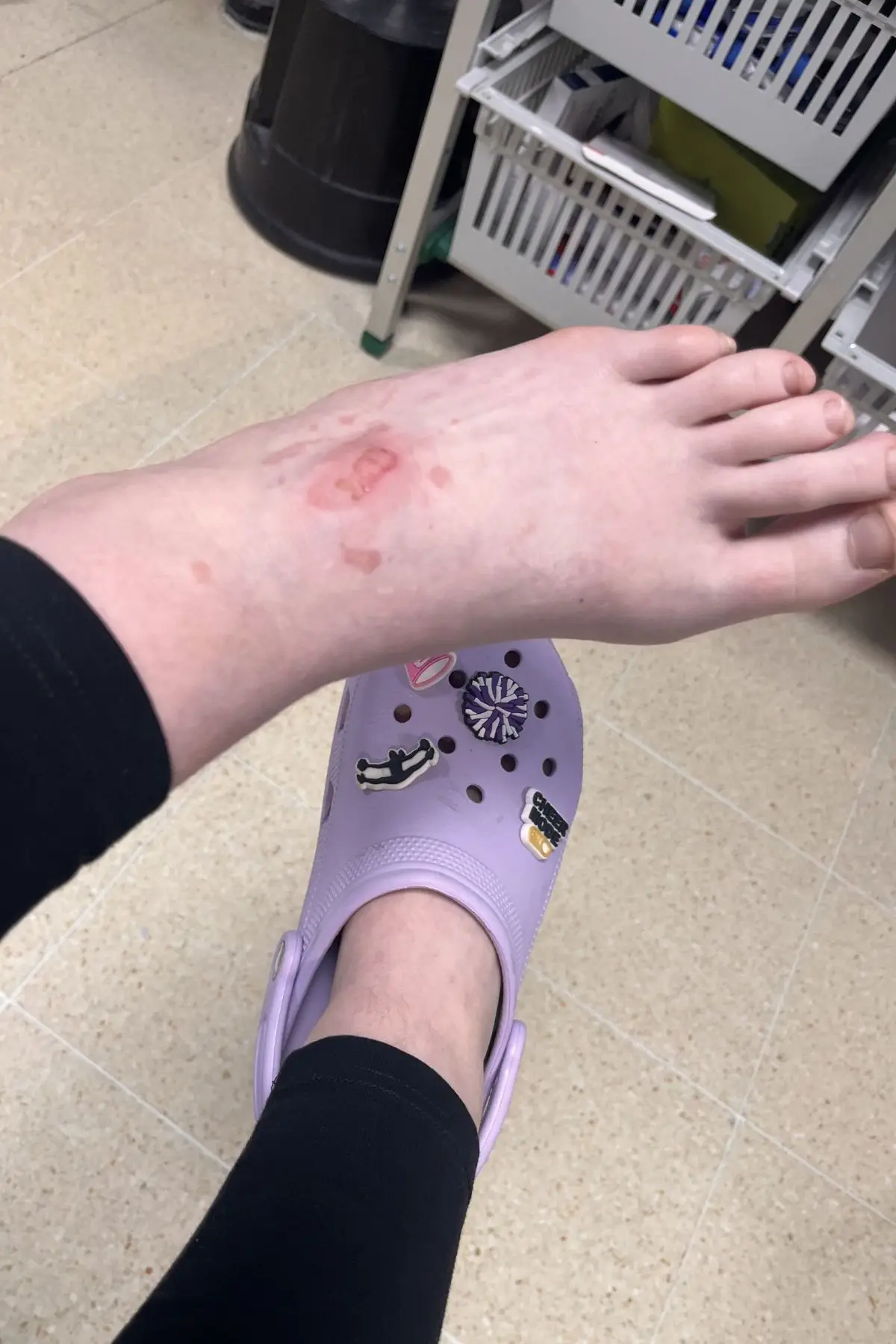 The sugar and water mixture is often referred to as 'Prison Napalm'. (Kennedy News and Media)