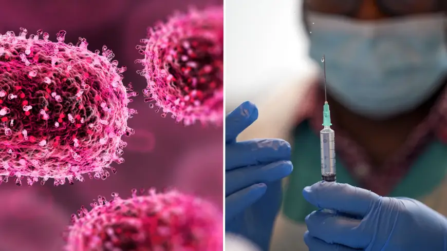 Mpox symptoms explained as UK prepares for outbreak after first European case is confirmed