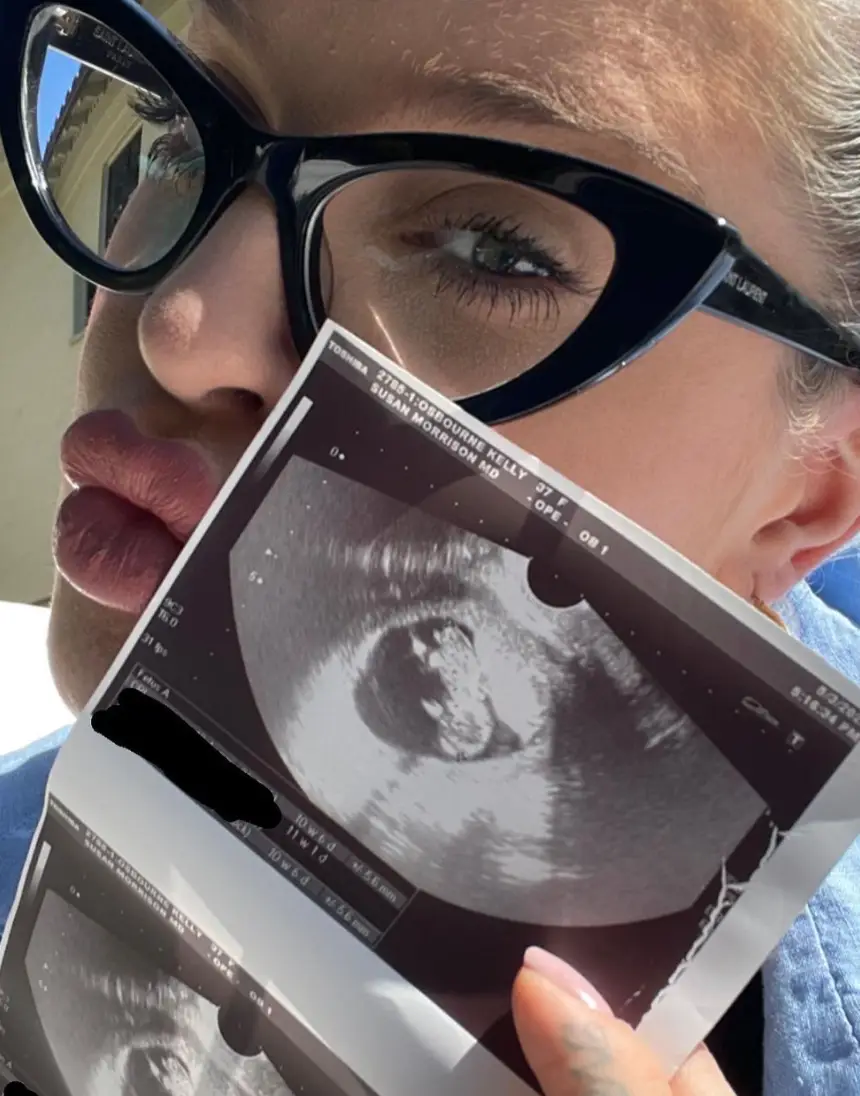 Kelly announced her pregnancy back in May.