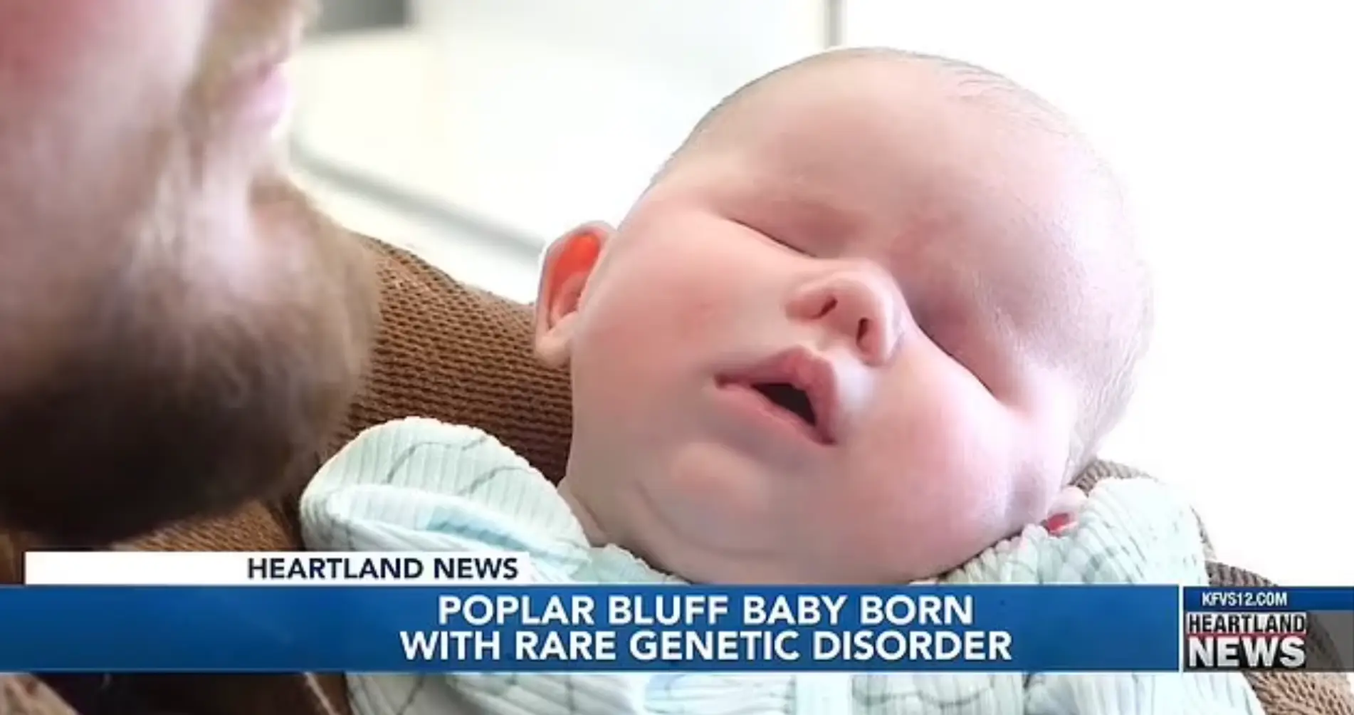 PRR-12 affects people differently.