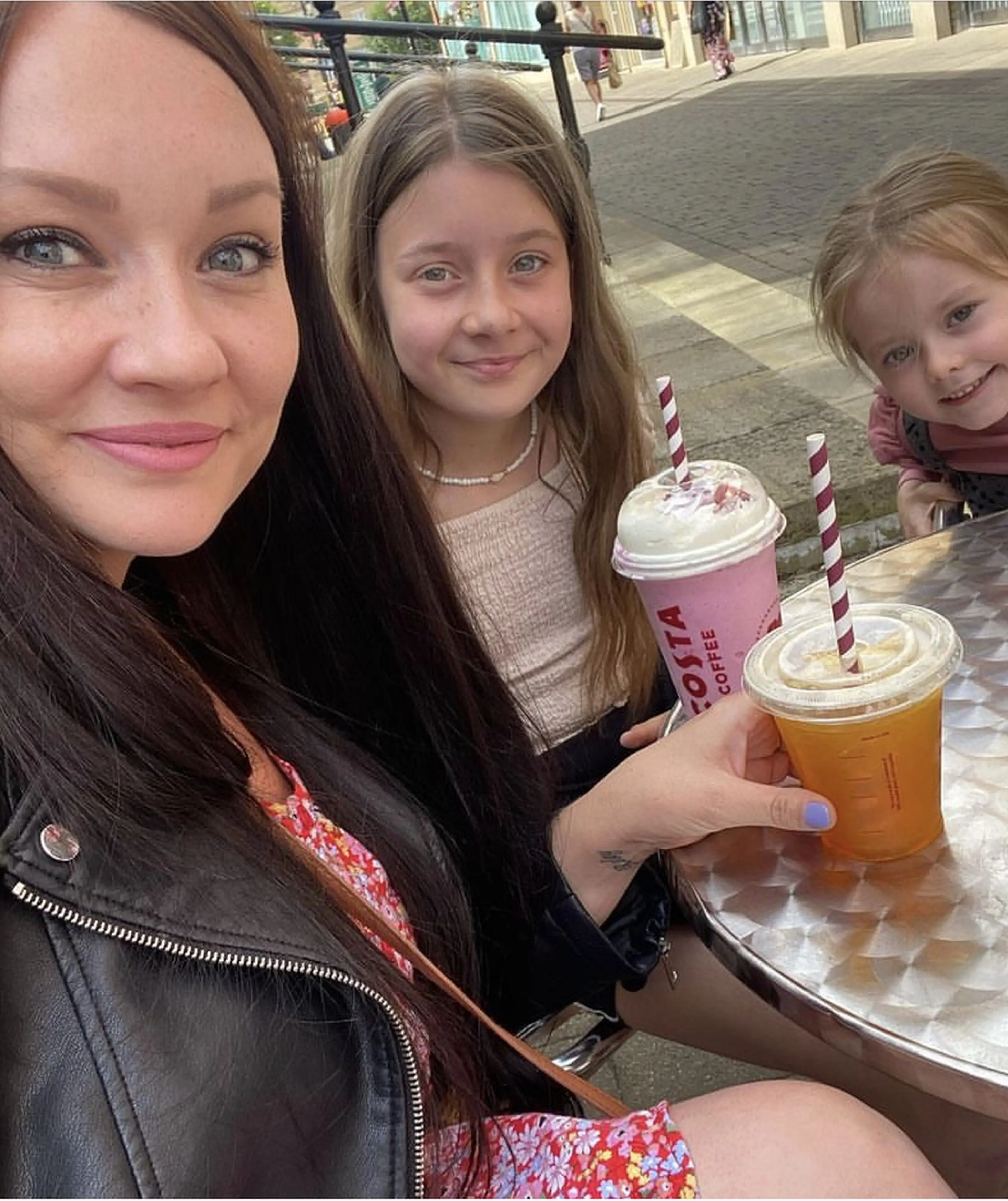 Mum Jenny Hill believes that the distinctive trait is caused by poliosis (