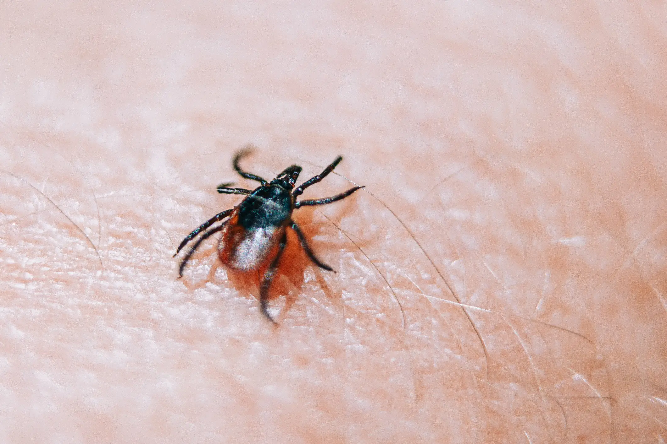 'Rabbit fever' can be spread through tick bits (Getty Stock Images)
