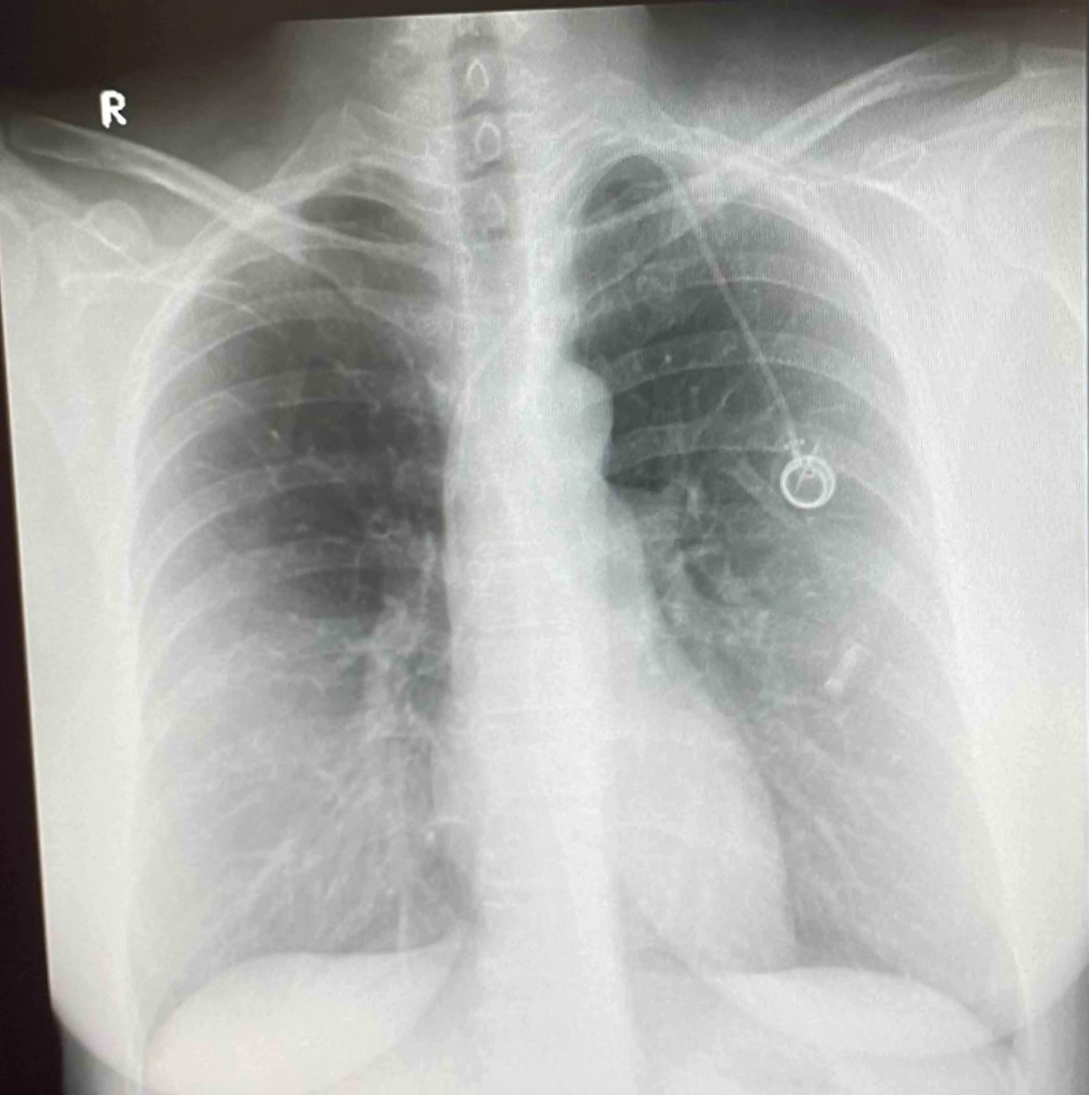 The mother is now under palliative care. (Kennedy News and Media)