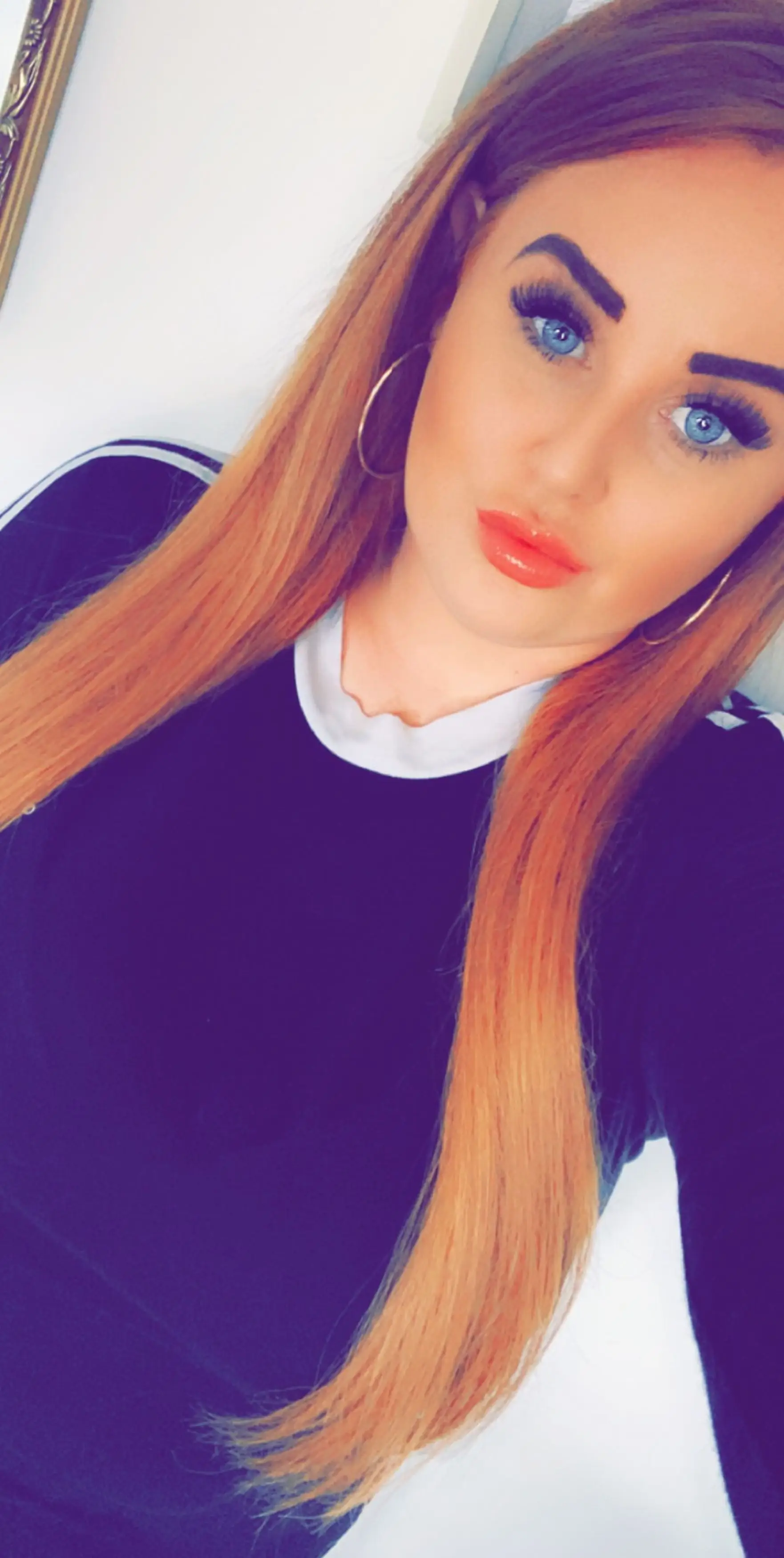 Michelle's eyebrows have now recovered.