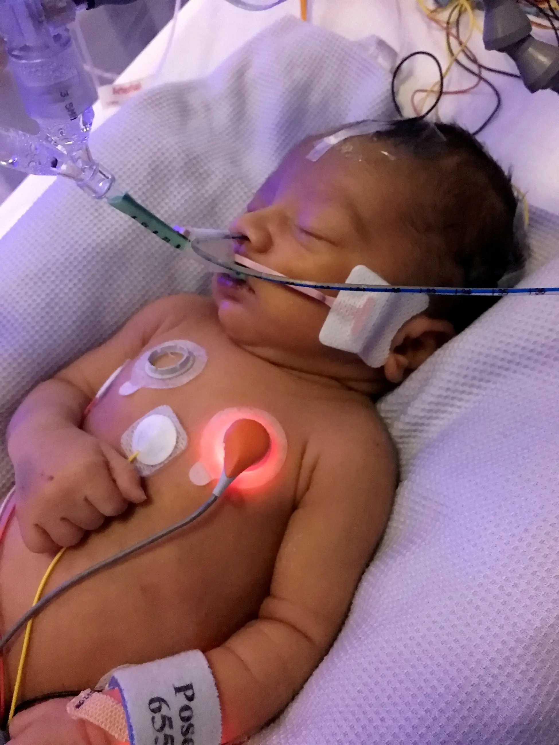 Now, the NHS trust has admitted liability and paid an initial payment.