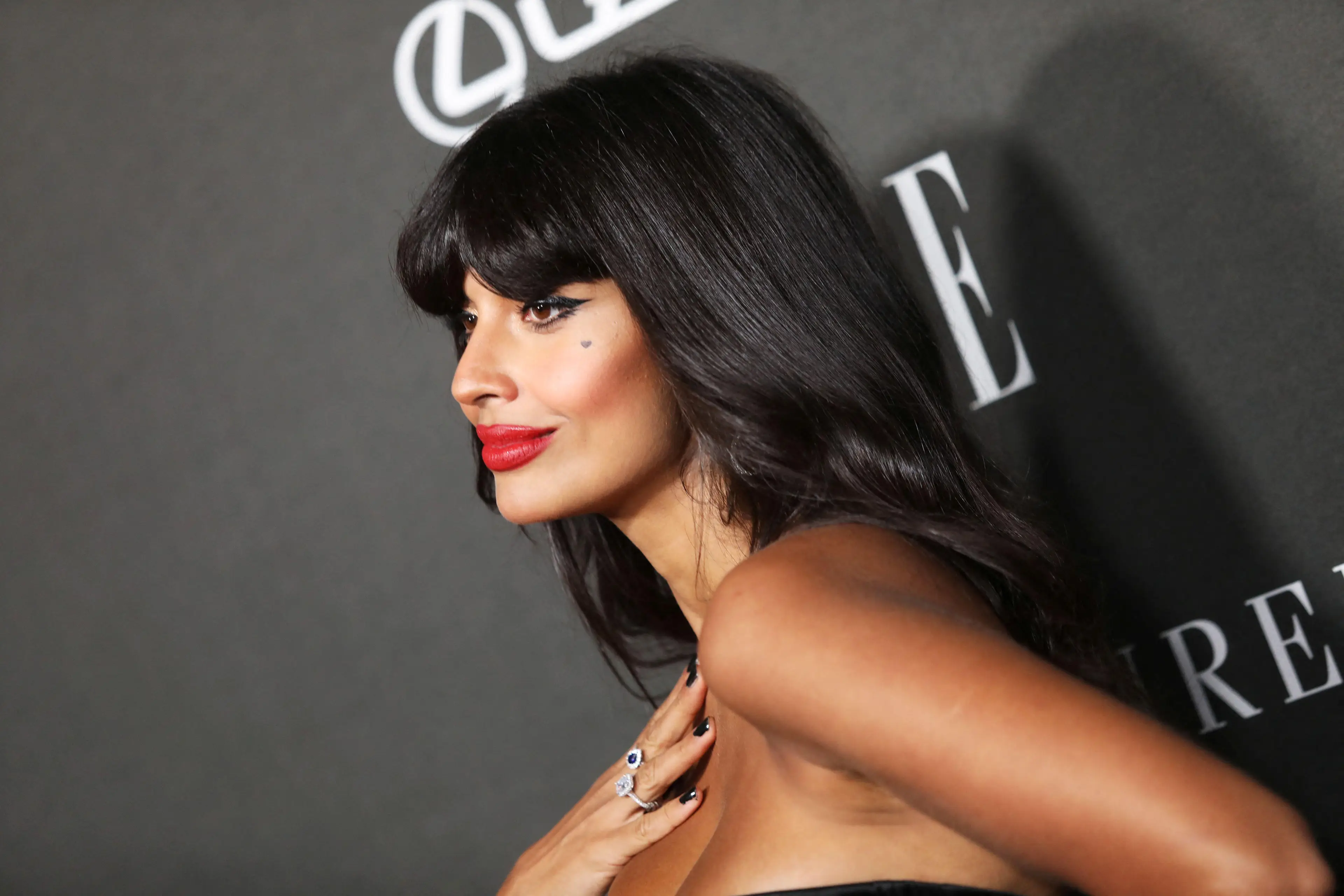 Jamil has a condition called Ehlers Danlos Syndrome.