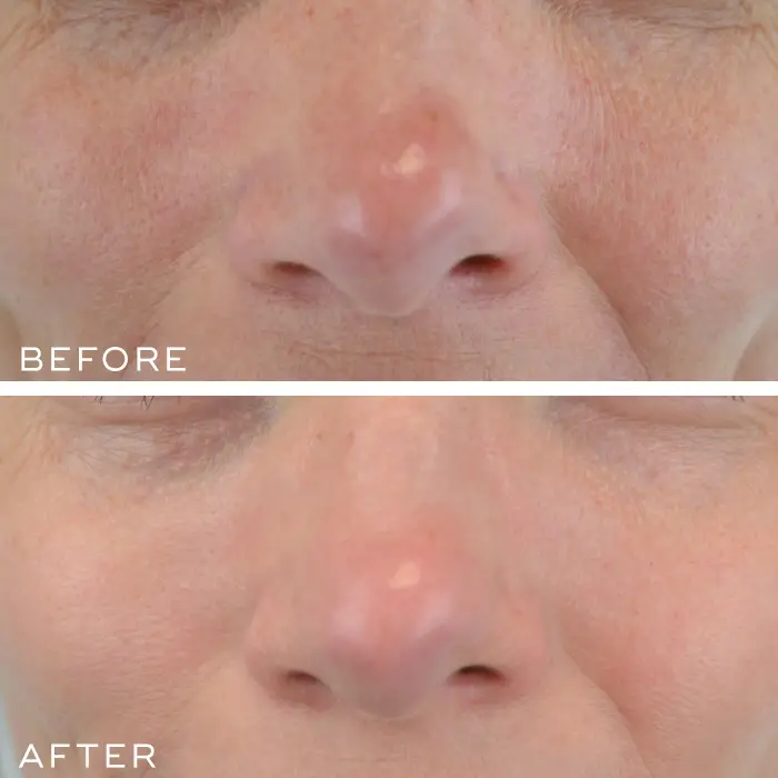 Shoppers have been impressed by the results.